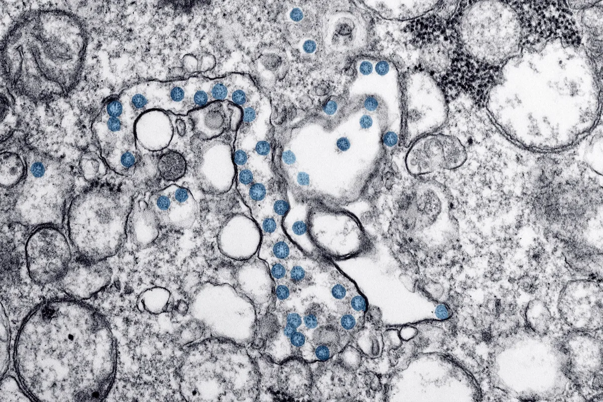 Electron-microscope style image of cell structures in gray with small blue particles.