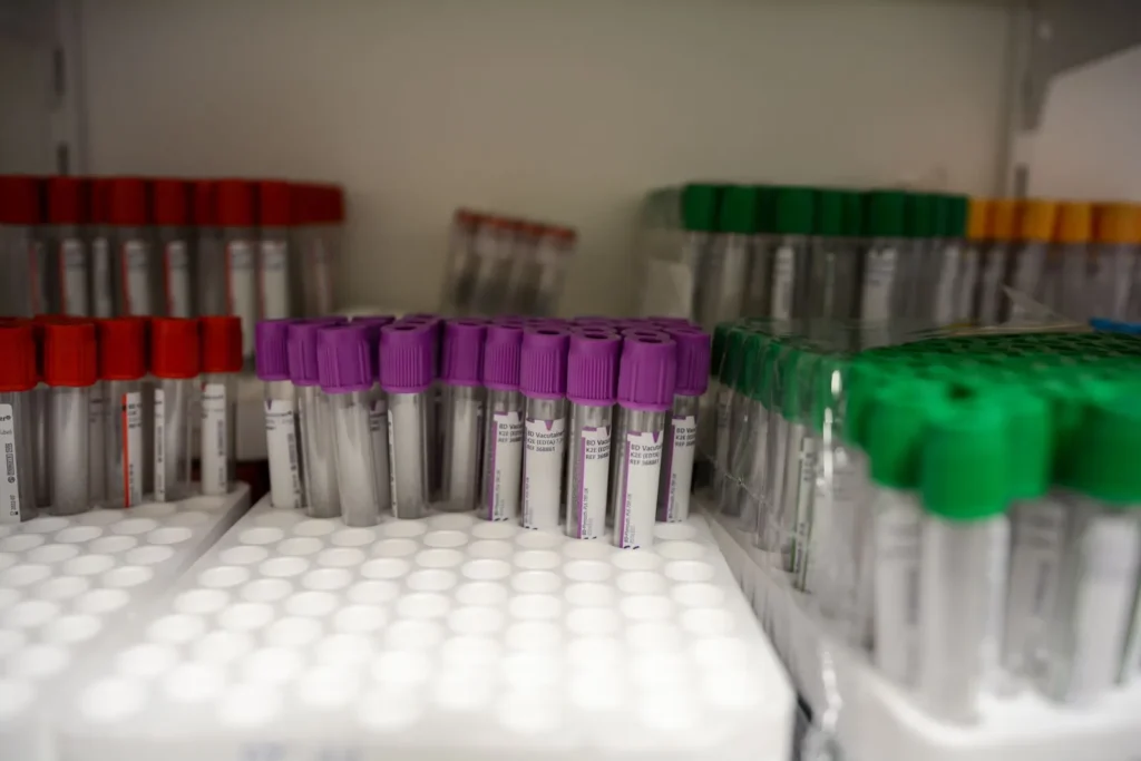 Racks of empty blood collection tubes with purple, red and green caps on a laboratory supply shelf.