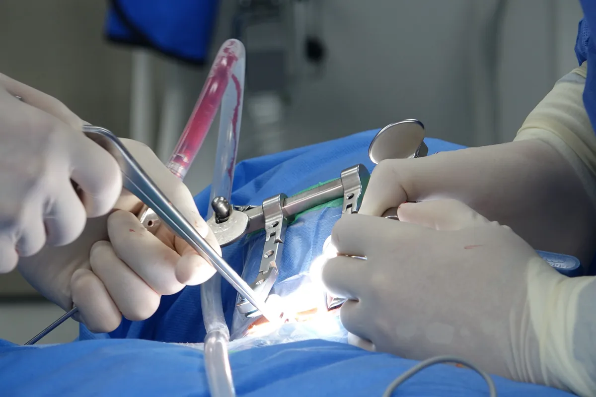 Surgeons in sterile gloves working with instruments during a spine operation.